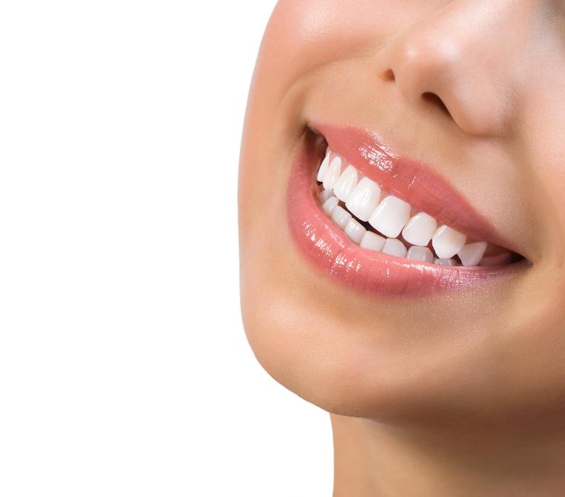 Woman smiling with white teeth, charlotte nc
