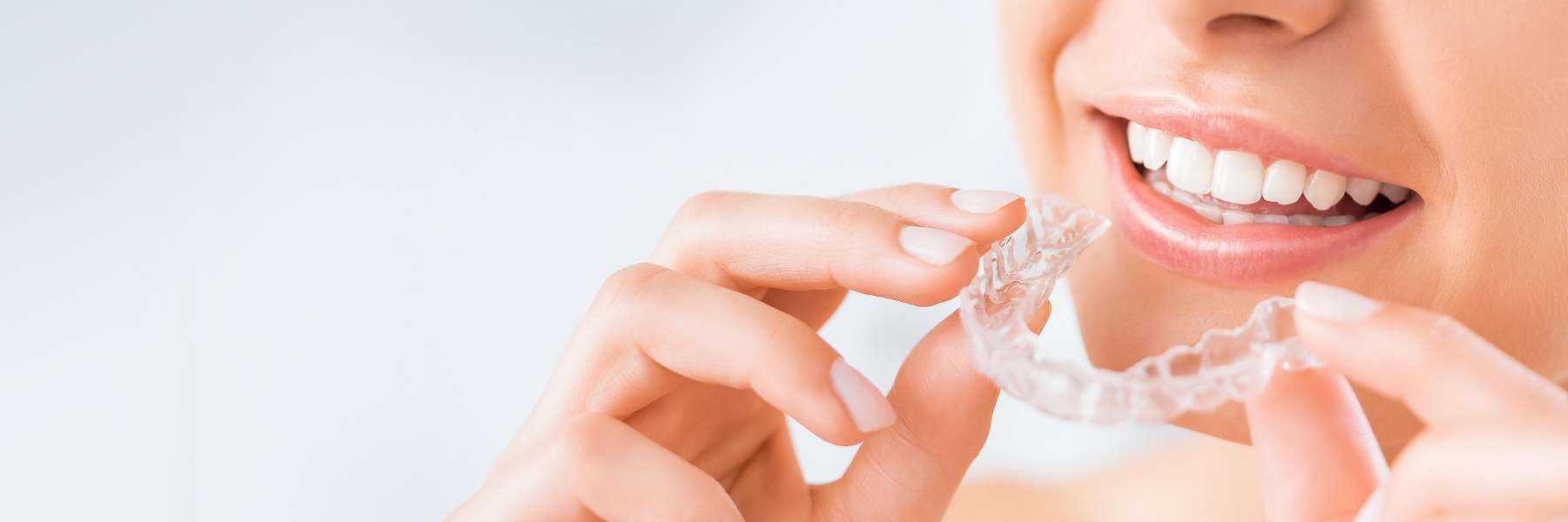 A woman holding her clear aligners