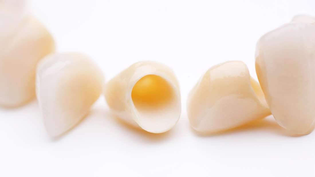 Can Dental Veneers Damage Healthy Teeth? Dental Veneers Charlotte