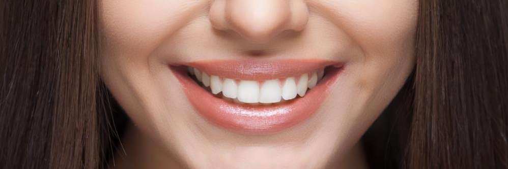 Close up of womans smile, charlotte nc