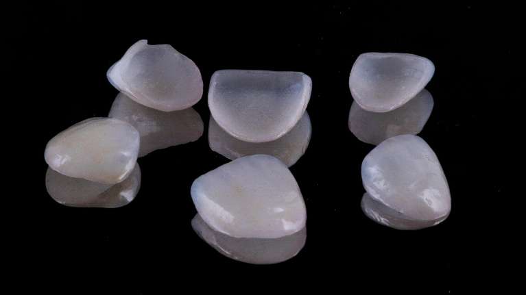Veneers | Charlotte Cosmetic Dentist