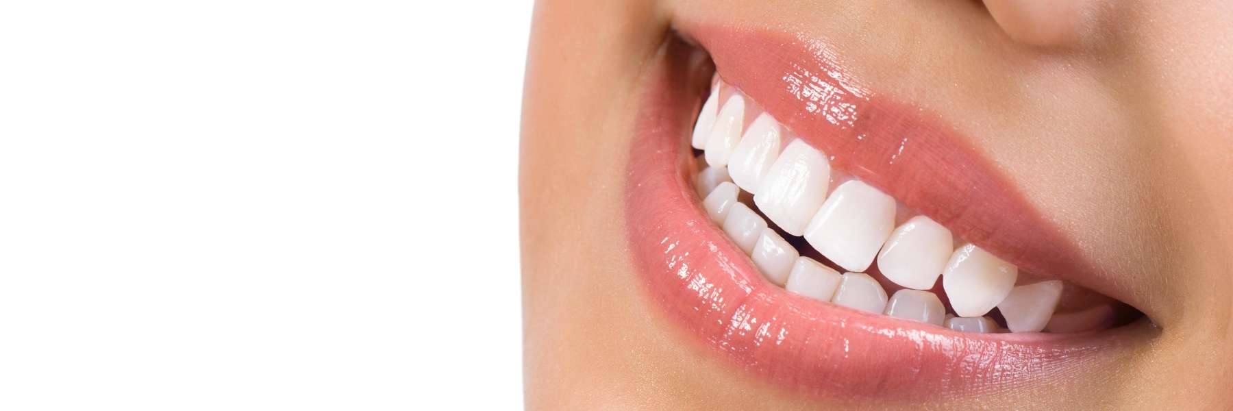 A smiling woman | Natural Dentist Charlotte