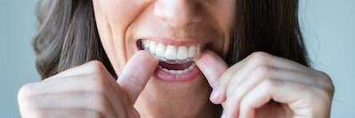 A woman putting in her Invisalign tray