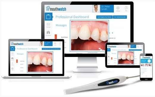 Intraoral Camera | Charlotte NC Dentist